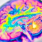 A-Study-Using-Advanced-Brain-Imaging-Hint-How-DMT-Changes-Reality-Perception