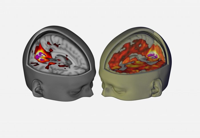 LSD Scans Reveal the Brain’s Secret Portal to Cosmic Consciousness 4 LSD scans